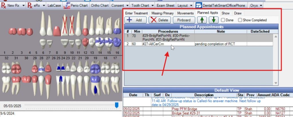 Open Dental Planned Appointments